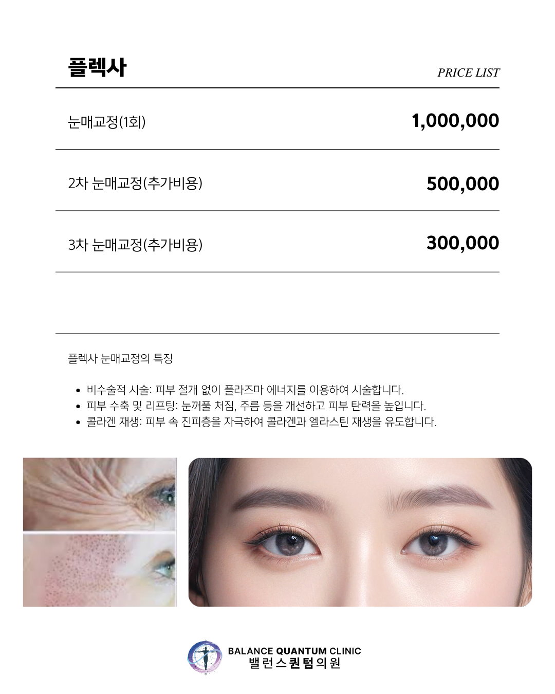 플렉사 눈매교정 안내